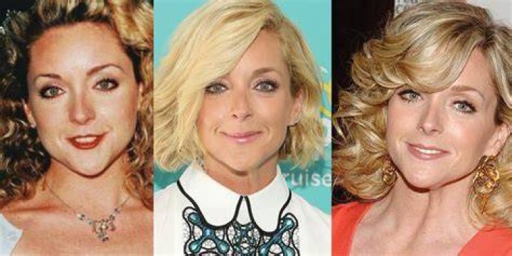 Jane Krakowski Plastic Surgery Before and After